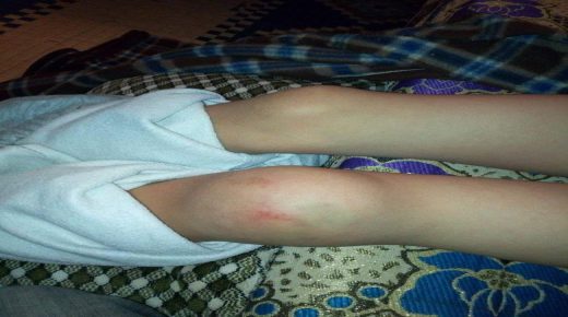 اوطاط الحاج… سقوط تلميذ بساحة مؤسسة تعليمية يحرك لجنة خاصة