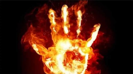 ثلاثيني يضرم النار في زوجة عمه بالرحامنة