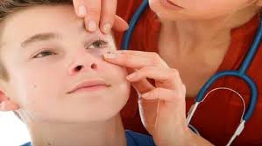 أعراض فقر الدم عند الأطفال