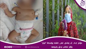 مؤلم جدا.. أب يعتدي على طفله بواسطة “فيتر” والأم تطالب بحق رضيعها