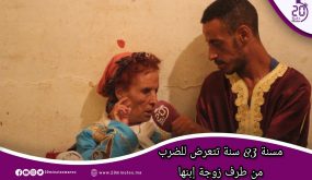 مسنة 83 سنة تتعرض للضرب من طرف زوجة إبنها وتطلب مساعدة المحسنين .