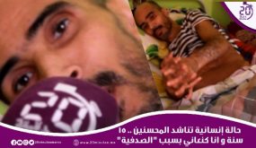 حالة إنسانية تناشد المحسنين..15 العام و أنا كنعاني بسسب ” الصدفية”