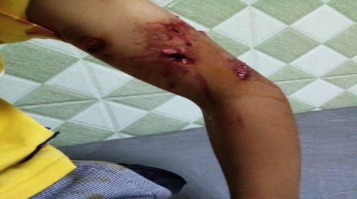 ميسور….كلاب مسعورة تهاجم تلميذا بدوار فرط جماعة سيدي بوطيب
