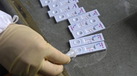 حجز مئات الإختبارات الخاصة بالكشف فيروس كورونا بطنجة على متن سيارة قادمة من هولندا