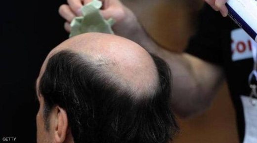 لا تتجاهل هذه العلامة في فروة الرأس