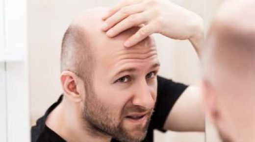 دواء يداوي مشكلتين لدى الرجال.. أشهرها تساقط الشعر