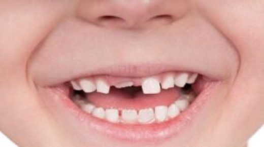 بسمة تواصل التزامها بإعطاء ابتسامة جديدة للأطفال