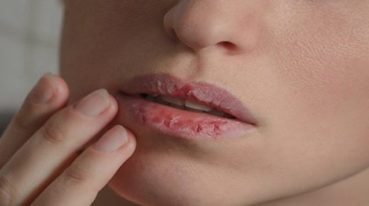 جفاف الفم من الأعراض الشائعة التي يجب الانتباه إليها