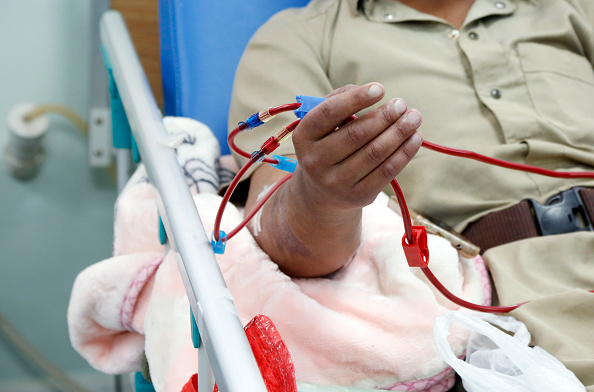 SANA'A, YEMEN - NOVEMBER 27: A patient suffering from kidney failure, receives dialysis treatment at al-Thawra hospital, on November 27, 2022 in Sana'a, Yemen. As a result of the ongoing blockade and crisis, an acute shortage of kidney failure treatment supplies across the country's kidney-treating health facilities exists and more than 5,000 patients suffering from kidney failure patients in the war-torn country, the health ministry threatened that they will die unless these centers have been helped, and provided with required medical supplies. (Photo by Mohammed Hamoud/Getty Images)