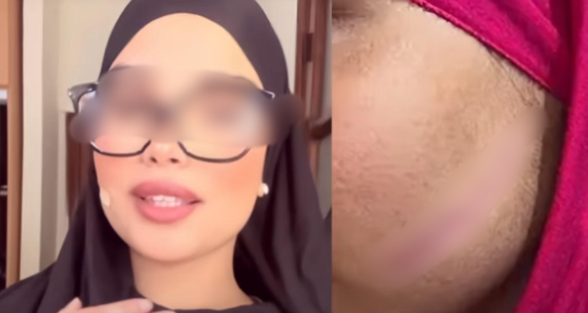 بعد 5 سنوات من الاعتداء.. “هاشتاغ كلنا سلمى” يشعل تيكتوك ويعيد المعتدية إلى قبضة الأمن