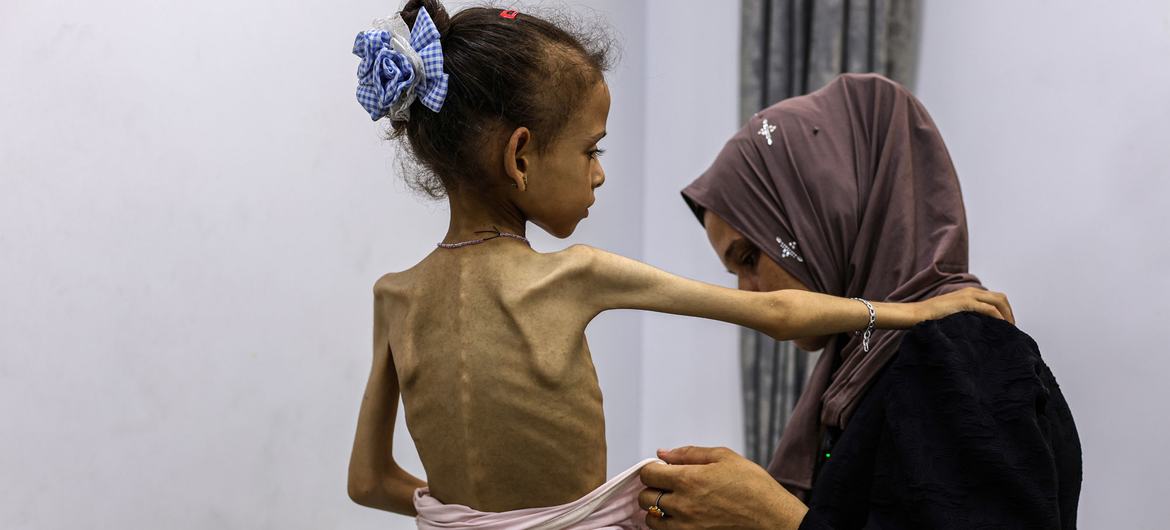 لأول مرة في الشرق الأوسط: إعلان رسمي بوقوع مجاعة في غزة