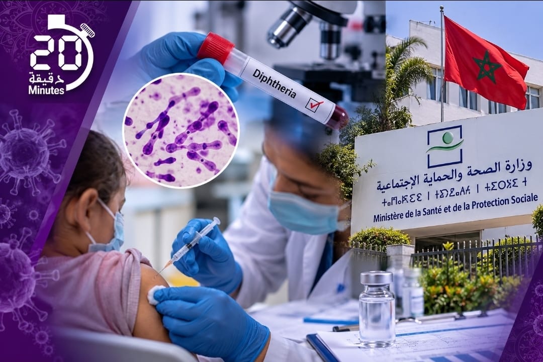 الدفتيريا بالمغرب.. خطة صحية لمحاصرة البؤر واستدراك التلقيح